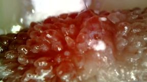 Medical Endoscope Oral Exam: Gummy Chewing, Extreme Teeth &amp; Tongue Macro