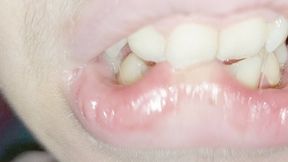 I BITE my lip -