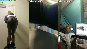 anal exposure montage