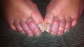 NATURAL RAW TOES - PHOTO VIDEO - HD