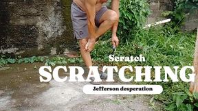 Man scratching his feet due to itching when cutting bush (T)