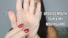 Updated mouth tour and my mouthguard - OnlyVanessa