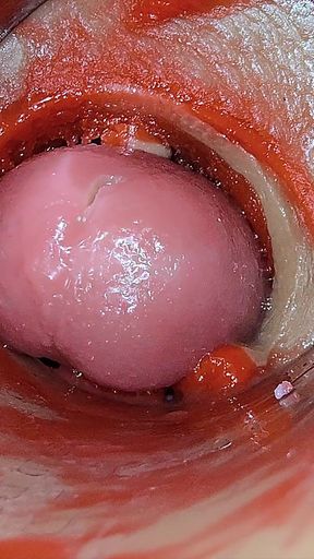 Camera Inside Deep Pussy Captures Overdose Ejaculation of Sperm Asmr