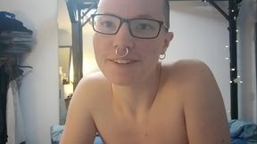 Bruises developing nicely :)