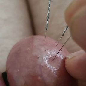 Needles in my balls