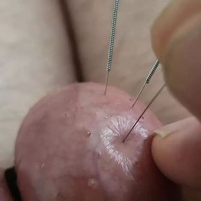 Needles in my balls