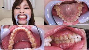 Sumire - Watching Inside mouth of Japanese cute girl bite-180-1 - wmv 1080p