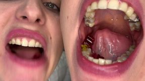 Twin Mouth: Chew Seduction Uvulia Show