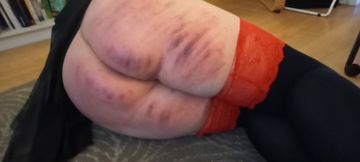 Layering bruises after a caning session 4 days ago