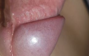 Amazing Upright Rough Venous Frenulum