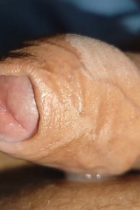Stepdaddy Opens His Phimosis and Gets a Big Load