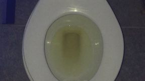 I PEE GOLD $_$