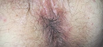 Session decontraction