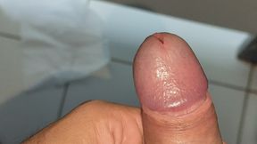 Large Deformed Cock with Lumpy Glans.