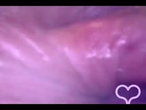 Anal Endoscope All the Way in My Transverse Colon!