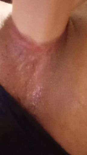 My Little Ass Hole