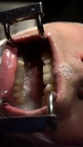 Spit and More Spit! Let Me Just Cover You!