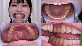 Mea Amemi - Watching Inside mouth of Japanese cute girl - MOV 1080p