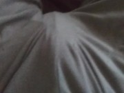 Bulging. This morning