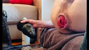 Outdoor Anal Adventure: Buttplugs & XXL Dildos Push Limits