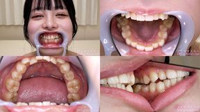 Wakaba Tsukimi - Watching Inside mouth of Japanese cute girl - MOV 1080p
