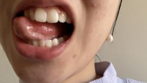 Let Aurora's Teeth Tempt You Madly