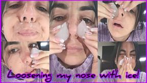 My nose is uncovered with ice!
