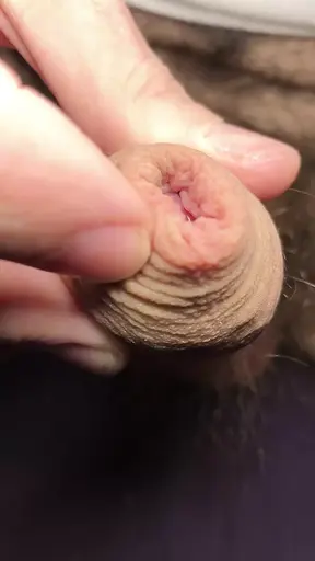 Closeup playing with my foreskin until my very hairy white dick gets hard