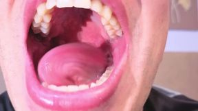 Tommas Johnson Private Show