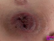 Banging Beauties Anal Speculum Threesome