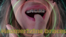 mesmrizingbracesdutch