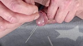 Double Pointed Needles, CBT, 10 Acupuncture Needles, Electric Dilator