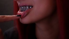 Braces and Nails... Great combination