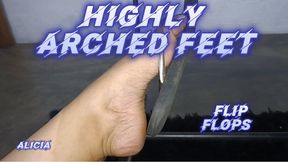 Pronounced arches and dangling flip-flops (2)