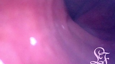 Anal Endoscope all the way in my Transverse Colon!