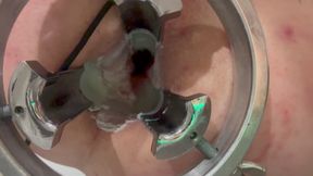 Pouring Hot Candle Wax Into Ass