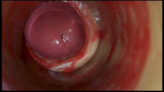 कपड़े पहने युवा शौकिया क्रॉसड्रेसर्स के क्लोज-अप संकलन में तीव्र गुदा मैथुन और स्खलन से पहले बड़े लिंगों को सहलाते हुए दिखाया गया है।