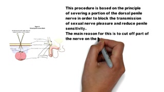 Premature Ejaculation Treatment Tutorial 1-4