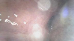 Deep in Bailey's Throat (New Endoscope Footage)