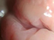 head and foreskin superzoom