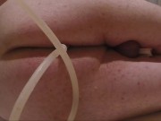 Retention Enema and Release