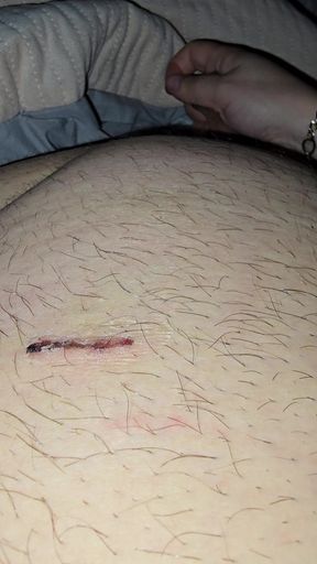 Step mom help injured step son with low erection with a handjob