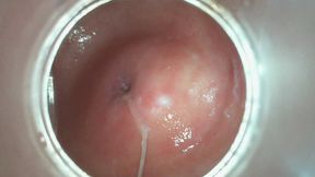 Cervix Contracting during orgasm