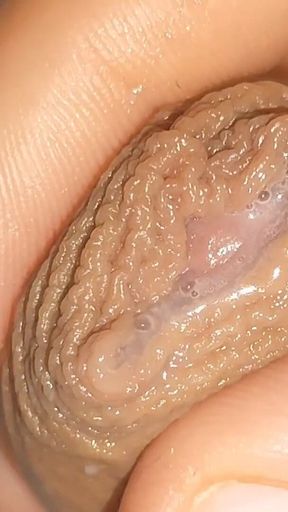 Curious Close-up of Pre-cum in Flaccid Phimosis.