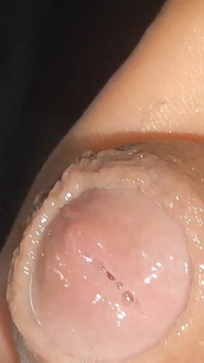 Curious Close-up of Pre-cum in Flaccid Phimosis.