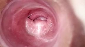 Playing with clear plug &ndash; cervix view