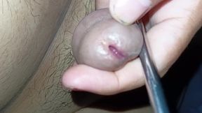 Abundant sperm