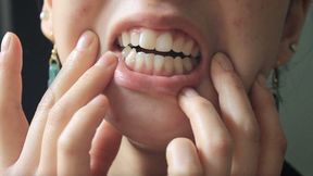 Aurora's Lovely Teeth Seduce You Part 2