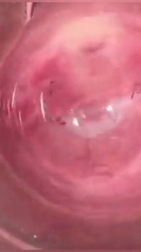Camera in Vagina, Cervix POV, Creampie   Clip 1