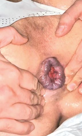 Anal Gape for Big Ass Crossdresser by Big Dildo